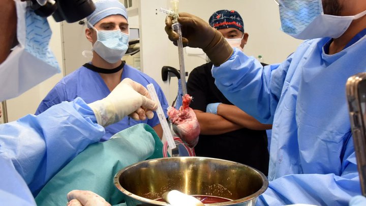 230922142517-02-pig-heart-transplant.jpg