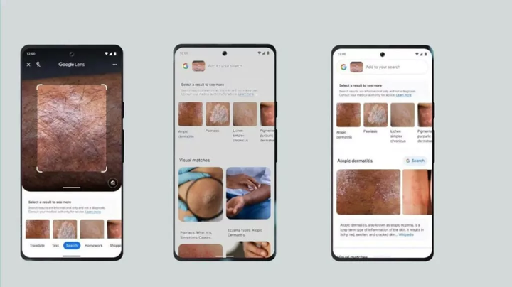 Google-Lens-Skin-1024x575.jpg.webp