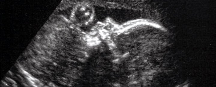 baby-ultrasound.jpg